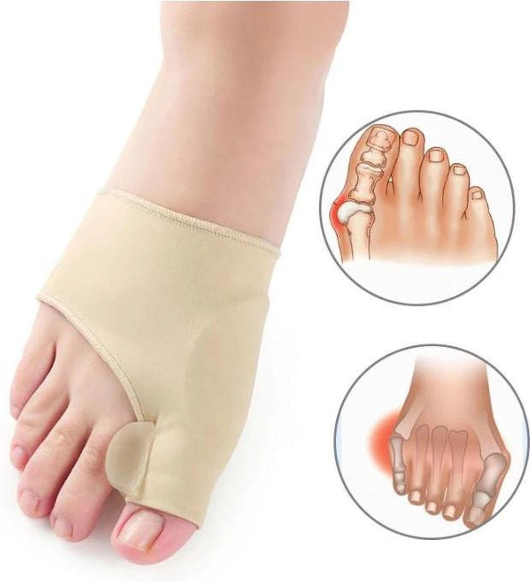 Merkloos Hallux Valgus Teen Spreider/Corrector Knobbel Teen Corrector |bunion | Eeltknobbel | Teen Rechtzetten | Comfortabel 1 Merkloos Hallux Valgus Teen Spreider/Corrector Knobbel Teen Corrector |bunion | Eeltknobbel | Teen Rechtzetten | Comfortabel