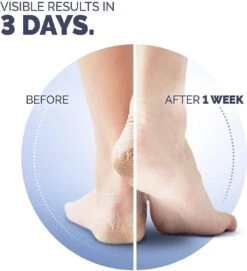 Scholl Klovenzalf - K+ Creme - Voor Hielkloven En Ruwe, Droge Huid 13 Scholl Klovenzalf - K+ Creme - Voor Hielkloven En Ruwe, Droge Huid -Verzorgingsproducten 1094x1200 1