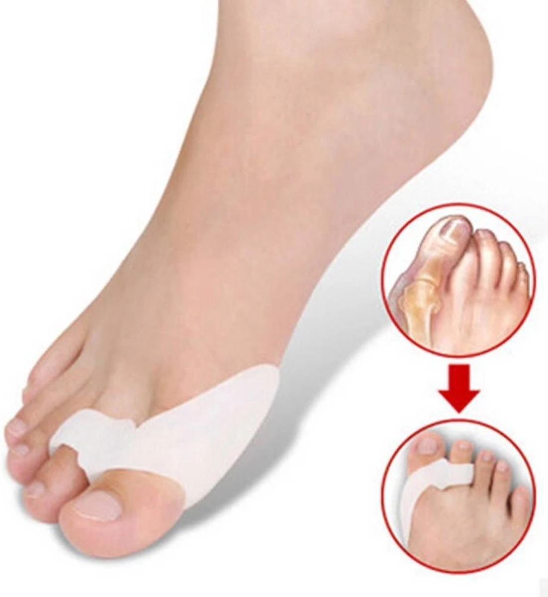 Now4You Hallux Valgus Siliconen Teenspreiders - 2 Stuks 1 Now4You Hallux Valgus Siliconen Teenspreiders - 2 Stuks