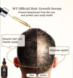 Merkloos Haarserum - Haargroei Stimulator - Tegen Haaruitval - Baardgroeimiddel 13 Merkloos Haarserum - Haargroei Stimulator - Tegen Haaruitval - Baardgroeimiddel -Verzorgingsproducten 1125x1200 11