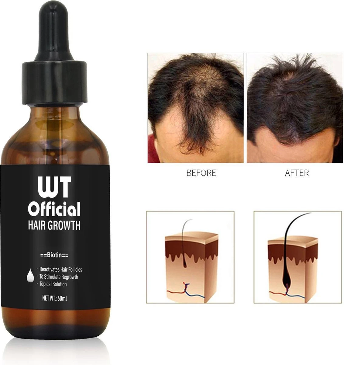 Merkloos Haarserum - Haargroei Stimulator - Tegen Haaruitval - Baardgroeimiddel 1 Merkloos Haarserum - Haargroei Stimulator - Tegen Haaruitval - Baardgroeimiddel