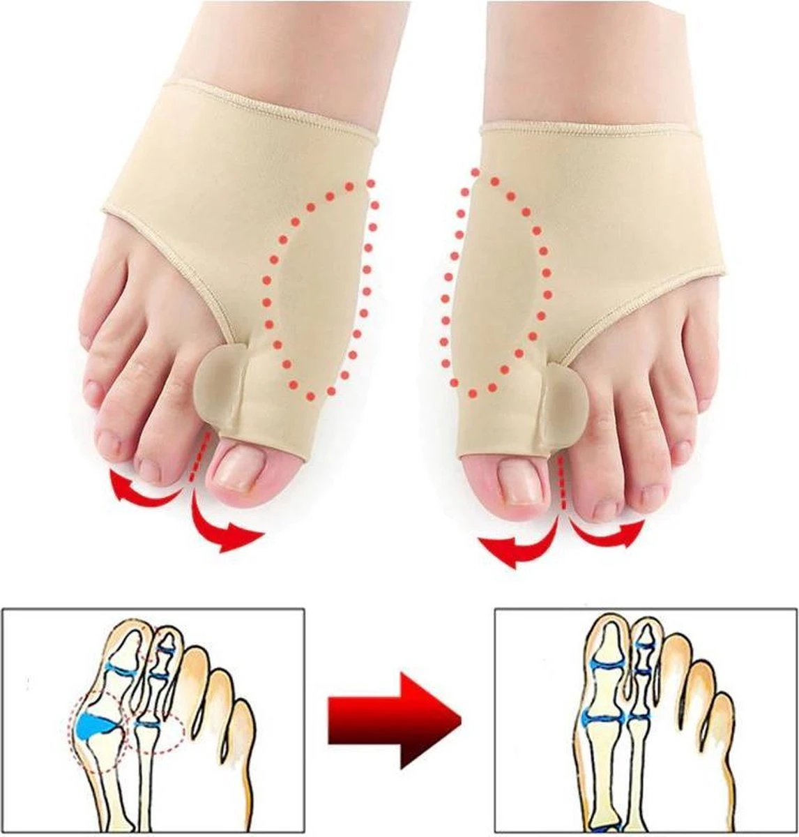 Hallux Valgus - Teenspreider - Teencorrector - Hallux Valgus Grote Teencorrector - Sok 2 Stuks 1 Hallux Valgus - Teenspreider - Teencorrector - Hallux Valgus Grote Teencorrector - Sok 2 Stuks