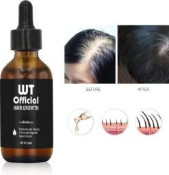 Merkloos Haarserum - Haargroei Stimulator - Tegen Haaruitval - Baardgroeimiddel 16 Merkloos Haarserum - Haargroei Stimulator - Tegen Haaruitval - Baardgroeimiddel -Verzorgingsproducten 1159x1200 6