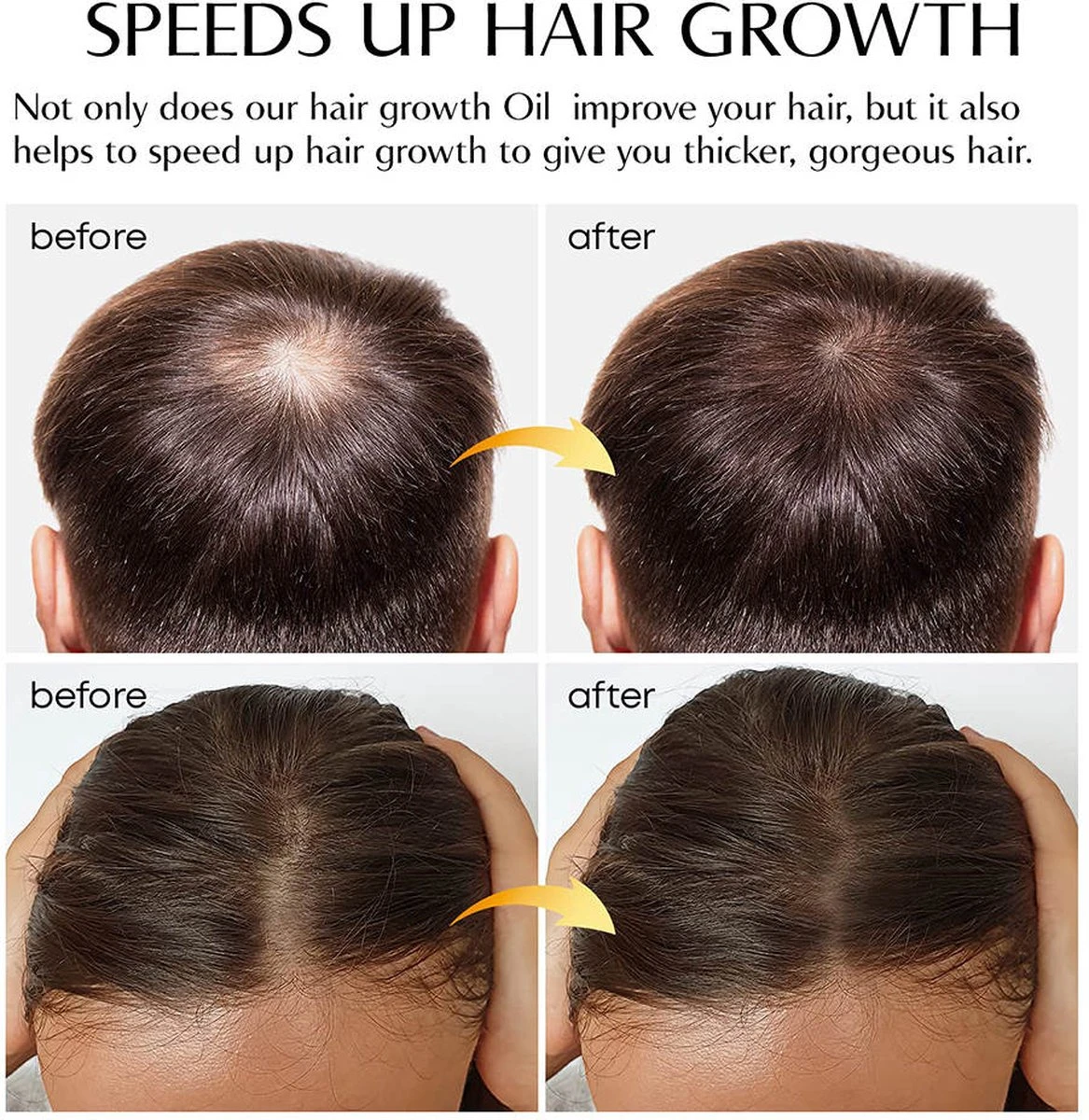 Haarserum - Haargroei Stimulator - Tegen Haaruitval - Baardgroeimiddel - Baardgroei Olie - Alternatief Voor Minoxidil 5% 4 Haarserum - Haargroei Stimulator - Tegen Haaruitval - Baardgroeimiddel - Baardgroei Olie - Alternatief Voor Minoxidil 5% - Afbeelding 4