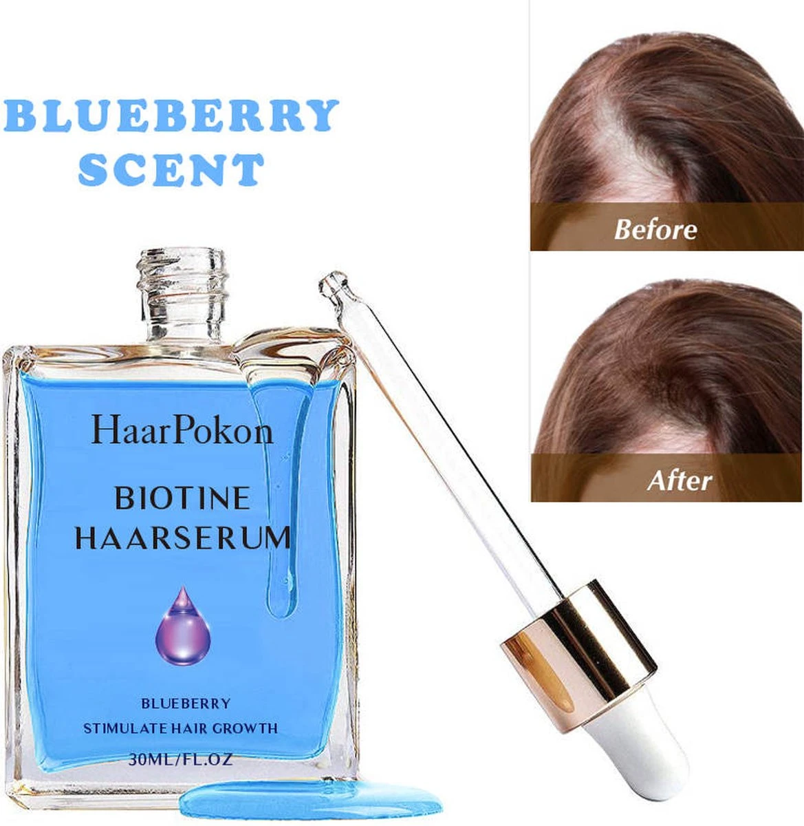 Haarserum - Haargroei Stimulator - Tegen Haaruitval - Baardgroeimiddel - Baardgroei Olie - Alternatief Voor Minoxidil 5% 1 Haarserum - Haargroei Stimulator - Tegen Haaruitval - Baardgroeimiddel - Baardgroei Olie - Alternatief Voor Minoxidil 5%