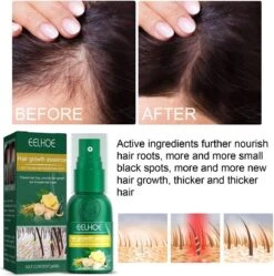 Gember Haargroei Serum - Superdeal - 1 + 1 GRATIS - Gember Haar Spray Voor Haargoei - Vollere Bos Haren - Anti Kaalheid - Haar Wordt Dikker - Ginger Hairspray - Ga Dunner Wordend Haar Tegen - Betere Baardgroei -Verzorgingsproducten 1191x1200 10