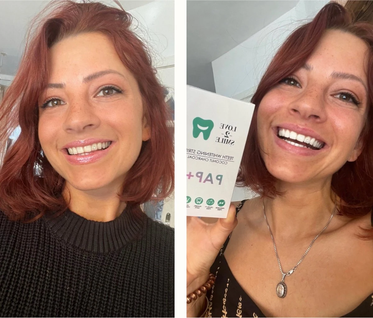 Love2smile PAP+ Premium Strips - Whitening Strips - De Natuurlijke Tandenbleker Van Nederland & België - Goedgekeurde Tandenbleek Strips - Teeth Whitening Strips - Wittere Tanden - Zonder Peroxide 4 Love2smile PAP+ Premium Strips - Whitening Strips - De Natuurlijke Tandenbleker Van Nederland & België - Goedgekeurde Tandenbleek Strips - Teeth Whitening Strips - Wittere Tanden - Zonder Peroxide - Afbeelding 4