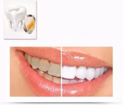 Merkloos Tanden Whitener Pen - Professionele Tandenbleek Gel - Tandenbleker 8 Merkloos Tanden Whitener Pen - Professionele Tandenbleek Gel - Tandenbleker -Verzorgingsproducten 1200x1026 1