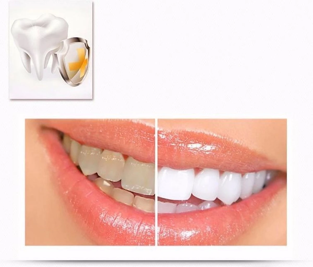 Merkloos Tanden Whitener Pen - Professionele Tandenbleek Gel - Tandenbleker 3 Merkloos Tanden Whitener Pen - Professionele Tandenbleek Gel - Tandenbleker - Afbeelding 3