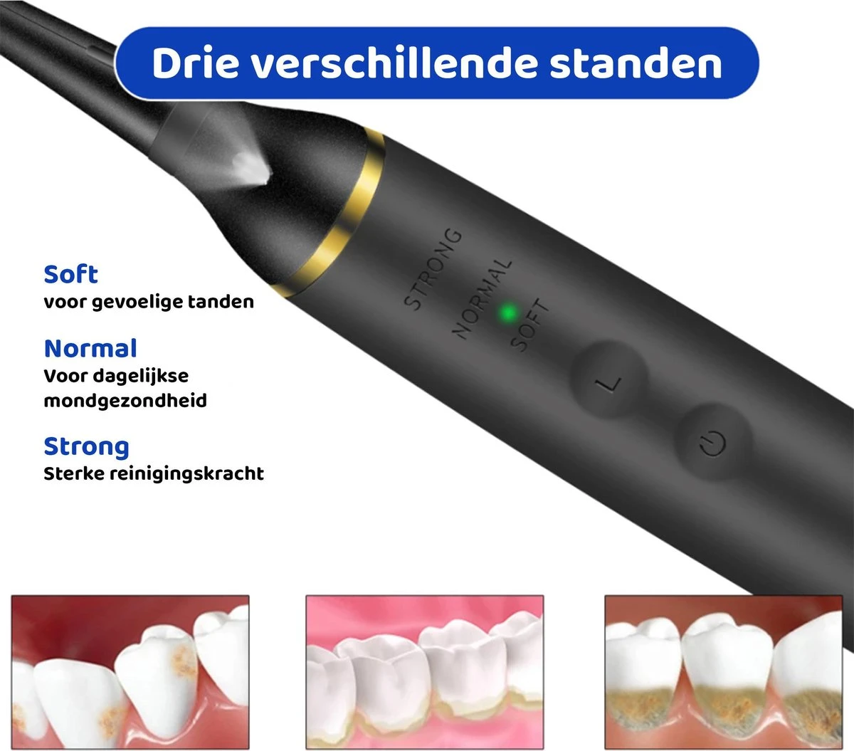 ExCorn Elektrische Tandsteen Verwijderaar - Inclusief 6-delig Tandartsset - 3 Standen - Elektrisch Tandplak Verwijderen - Tanden Polijsten 6 ExCorn Elektrische Tandsteen Verwijderaar - Inclusief 6-delig Tandartsset - 3 Standen - Elektrisch Tandplak Verwijderen - Tanden Polijsten - Afbeelding 6