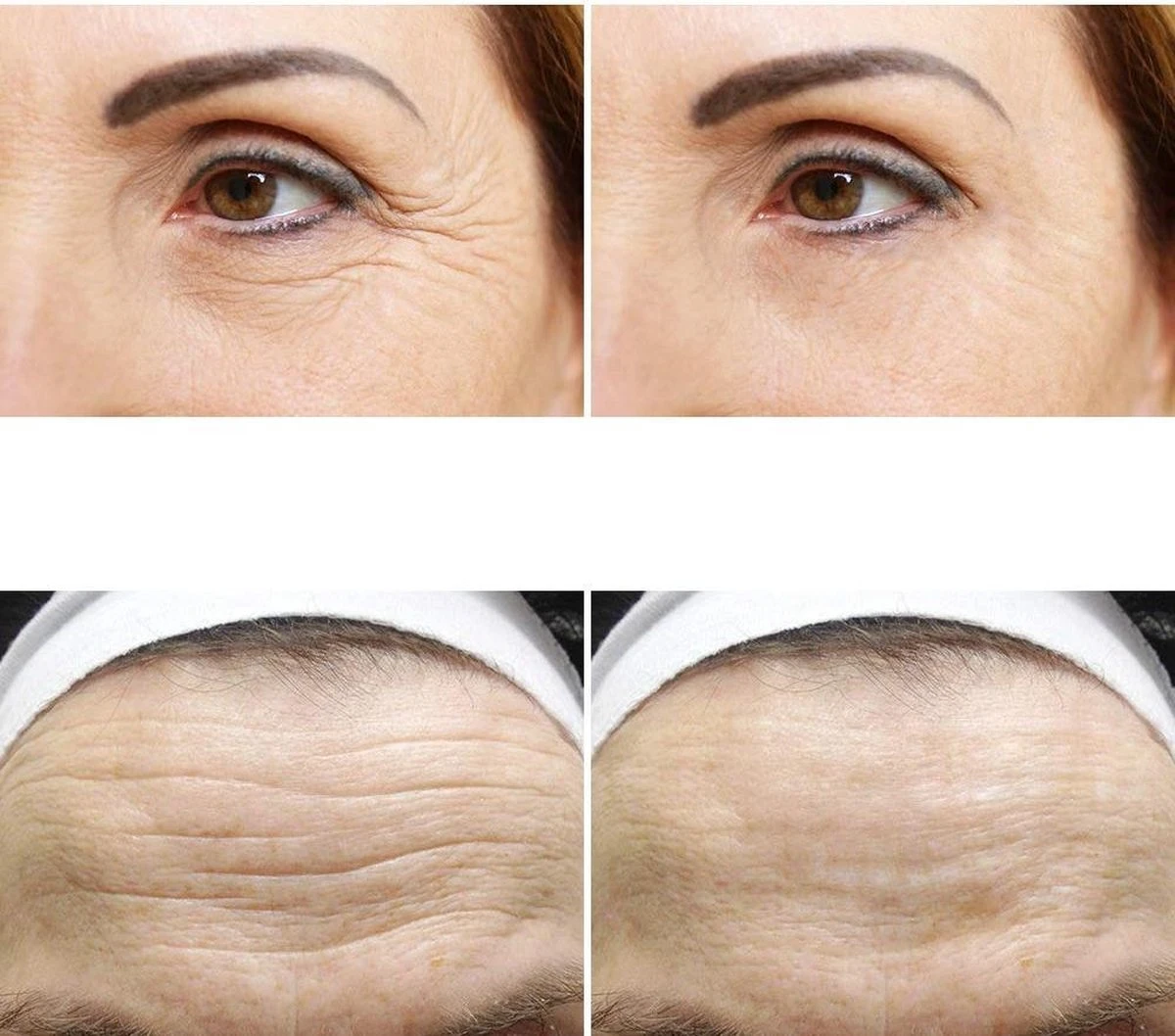 Simia™ Anti Rimpel Beauty Pads - Face Set (7 Stuks) - Voorhoofd Mond & Ogen - Herbruikbaar Anti Aging Siliconen Pad Tegen Lijntjes En Rimpels 2 Simia™ Anti Rimpel Beauty Pads - Face Set (7 Stuks) - Voorhoofd Mond & Ogen - Herbruikbaar Anti Aging Siliconen Pad Tegen Lijntjes En Rimpels - Afbeelding 2