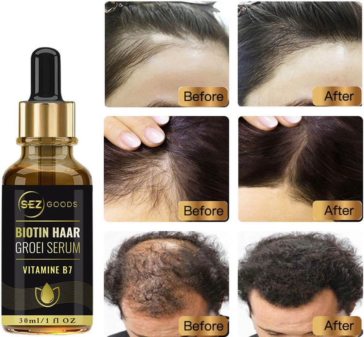 Haarserum - Haargroei Stimulator - Tegen Haaruitval - Haargroei Serum - Baardgroeimiddel - Baardgroei Olie - Alternatief Voor Minoxidil 5% 3 Haarserum - Haargroei Stimulator - Tegen Haaruitval - Haargroei Serum - Baardgroeimiddel - Baardgroei Olie - Alternatief Voor Minoxidil 5% - Afbeelding 3