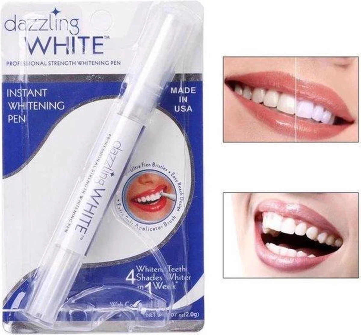 Merkloos Tanden Whitener Pen - Professionele Tandenbleek Gel - Tandenbleker 1 Merkloos Tanden Whitener Pen - Professionele Tandenbleek Gel - Tandenbleker