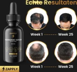 Zapply Haargroei Serum - Biotine - Haaruitval - Alternatief Minoxidil- Haarserum- Haargroei - Baardgroei - 9 Zapply Haargroei Serum - Biotine - Haaruitval - Alternatief Minoxidil- Haarserum- Haargroei - Baardgroei - -Verzorgingsproducten 1200x1122 6