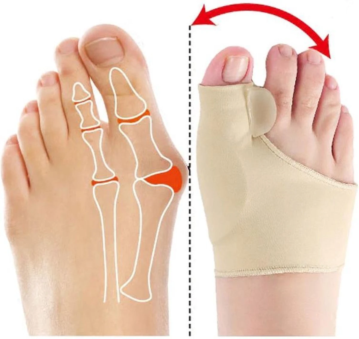 Hallux Valgus - Teenspreider - Teencorrector - Hallux Valgus Grote Teencorrector - Sok 2 Stuks 3 Hallux Valgus - Teenspreider - Teencorrector - Hallux Valgus Grote Teencorrector - Sok 2 Stuks - Afbeelding 3