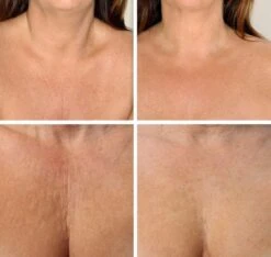 Simia™ Anti Rimpel Beauty Pads - Decolleté Large T Shape Set (2 Stuks) - Herbruikbaar Anti Aging Siliconen Pad Tegen Lijntjes En Slaaprimpels 9 Simia™ Anti Rimpel Beauty Pads - Decolleté Large T Shape Set (2 Stuks) - Herbruikbaar Anti Aging Siliconen Pad Tegen Lijntjes En Slaaprimpels -Verzorgingsproducten 1200x1139 2