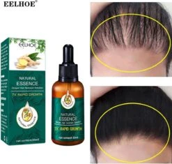 Gember Haargroei Serum - Superdeal - 1 + 1 GRATIS - Gember Haar Spray Voor Haargoei - Vollere Bos Haren - Anti Kaalheid - Haar Wordt Dikker - Ginger Hairspray - Ga Dunner Wordend Haar Tegen - Betere Baardgroei -Verzorgingsproducten 1200x1141 6