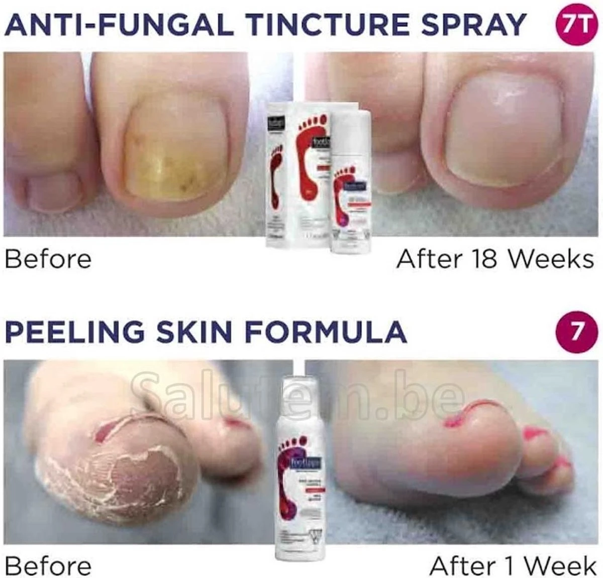 Footlogix Toe Nail Tincture Nagelspray 3 Footlogix Toe Nail Tincture Nagelspray - Afbeelding 3
