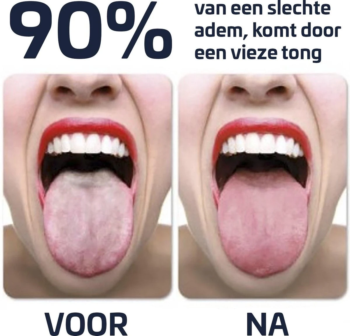 Effectieve Tongschraper - Tongreiniger - Rose Goud 1 Effectieve Tongschraper - Tongreiniger - Rose Goud