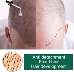 Gember Haargroei Serum - Superdeal - 1 + 1 GRATIS - Gember Haar Spray Voor Haargoei - Vollere Bos Haren - Anti Kaalheid - Haar Wordt Dikker - Ginger Hairspray - Ga Dunner Wordend Haar Tegen - Betere Baardgroei -Verzorgingsproducten 1200x1168 5