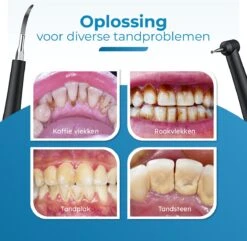 Professionele Tandsteen Verwijderaar - 5 Standen - Inclusief Tandarts Set - Met 3 Opzetstukken - Elektrisch - Tandplak -Verzorgingsproducten 1200x1169 4