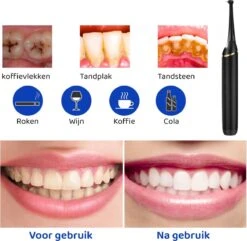 ExCorn Elektrische Tandsteen Verwijderaar - Inclusief 6-delig Tandartsset - 3 Standen - Elektrisch Tandplak Verwijderen - Tanden Polijsten 13 ExCorn Elektrische Tandsteen Verwijderaar - Inclusief 6-delig Tandartsset - 3 Standen - Elektrisch Tandplak Verwijderen - Tanden Polijsten -Verzorgingsproducten 1200x1173 4