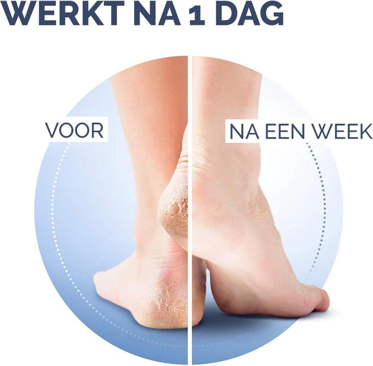 Scholl Klovenzalf - K+ Creme - Voor Hielkloven En Ruwe, Droge Huid 4 Scholl Klovenzalf - K+ Creme - Voor Hielkloven En Ruwe, Droge Huid - Afbeelding 4