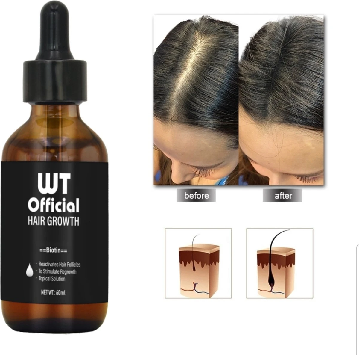 Merkloos Haarserum - Haargroei Stimulator - Tegen Haaruitval - Baardgroeimiddel 2 Merkloos Haarserum - Haargroei Stimulator - Tegen Haaruitval - Baardgroeimiddel - Afbeelding 2