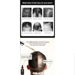 Merkloos Haarserum - Haargroei Stimulator - Tegen Haaruitval - Baardgroeimiddel 14 Merkloos Haarserum - Haargroei Stimulator - Tegen Haaruitval - Baardgroeimiddel -Verzorgingsproducten 1200x1197 14