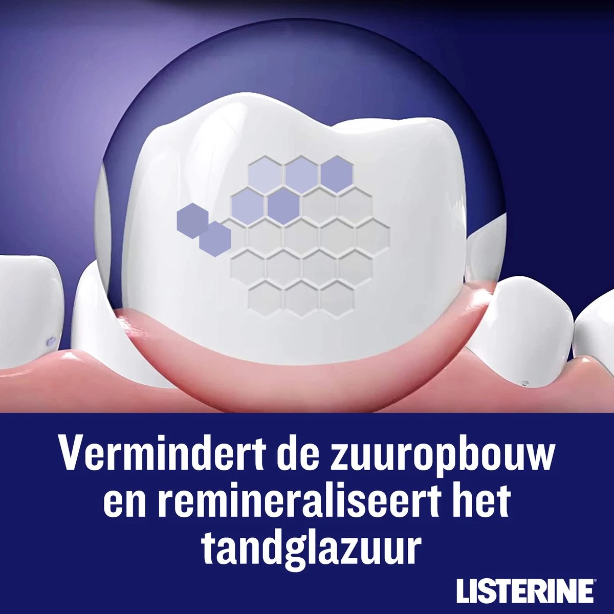 LISTERINE Nightly Reset Milde Smaak, Mondspoeling Met RAPID-FUSHION -technologie Voor Gebruik Tijdens De Nacht, Hermineraliseert Het Tandglazuur, 3 X 400 Ml 6 LISTERINE Nightly Reset Milde Smaak, Mondspoeling Met RAPID-FUSHION -technologie Voor Gebruik Tijdens De Nacht, Hermineraliseert Het Tandglazuur, 3 X 400 Ml - Afbeelding 6