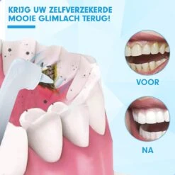 DEN-T® PRO P350 Elektrische Tandenpolijster - Wit - 5 Standen - 5 Opzetstukken - Polijstmachine - Polijstset - Tanden Polijsten - 12 DEN-T® PRO P350 Elektrische Tandenpolijster - Wit - 5 Standen - 5 Opzetstukken - Polijstmachine - Polijstset - Tanden Polijsten - -Verzorgingsproducten 1200x1200 1100