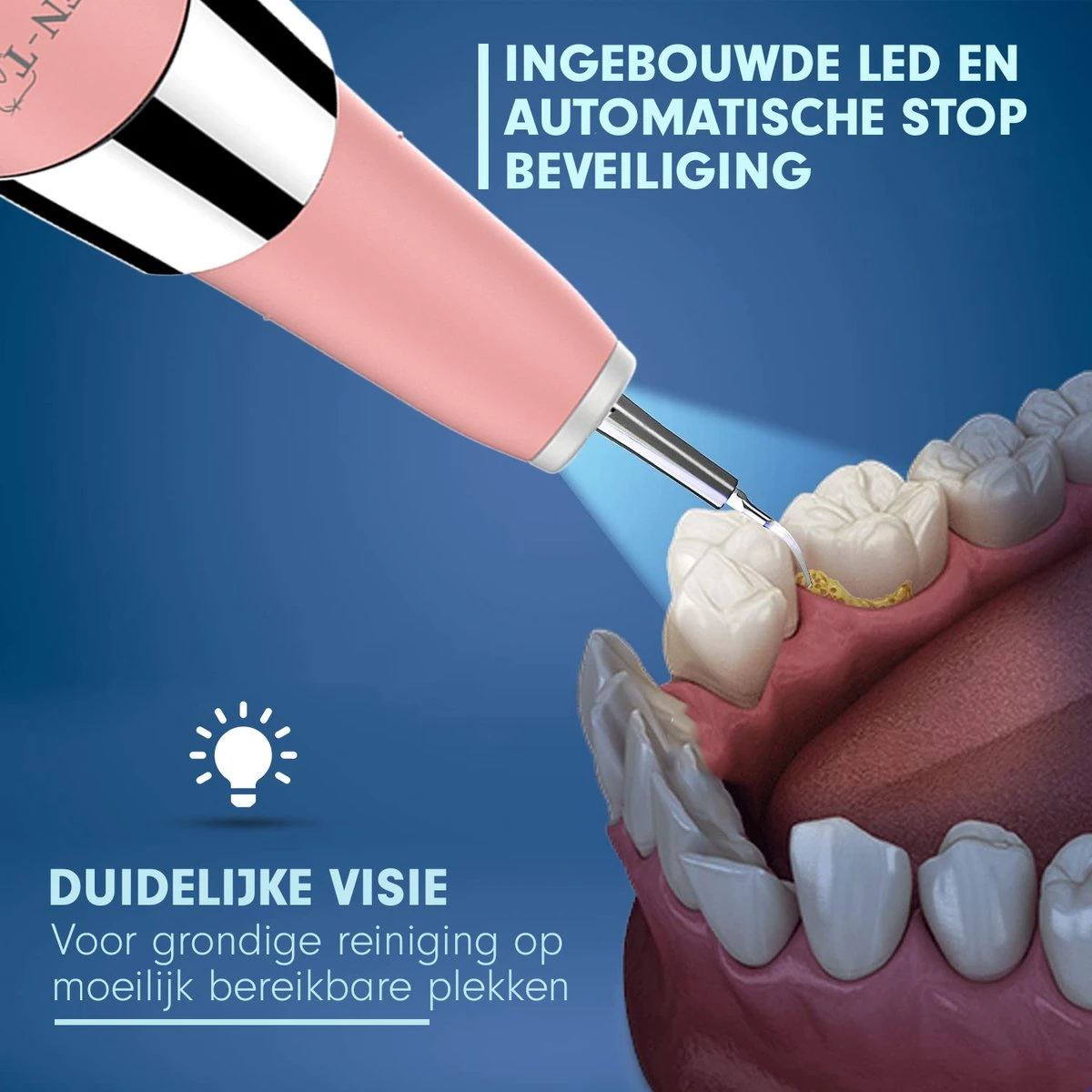 DEN-T® PRO U500 - Elektrische Sonische Tandsteen Verwijderaar - Roze 3 DEN-T® PRO U500 - Elektrische Sonische Tandsteen Verwijderaar - Roze - Afbeelding 3