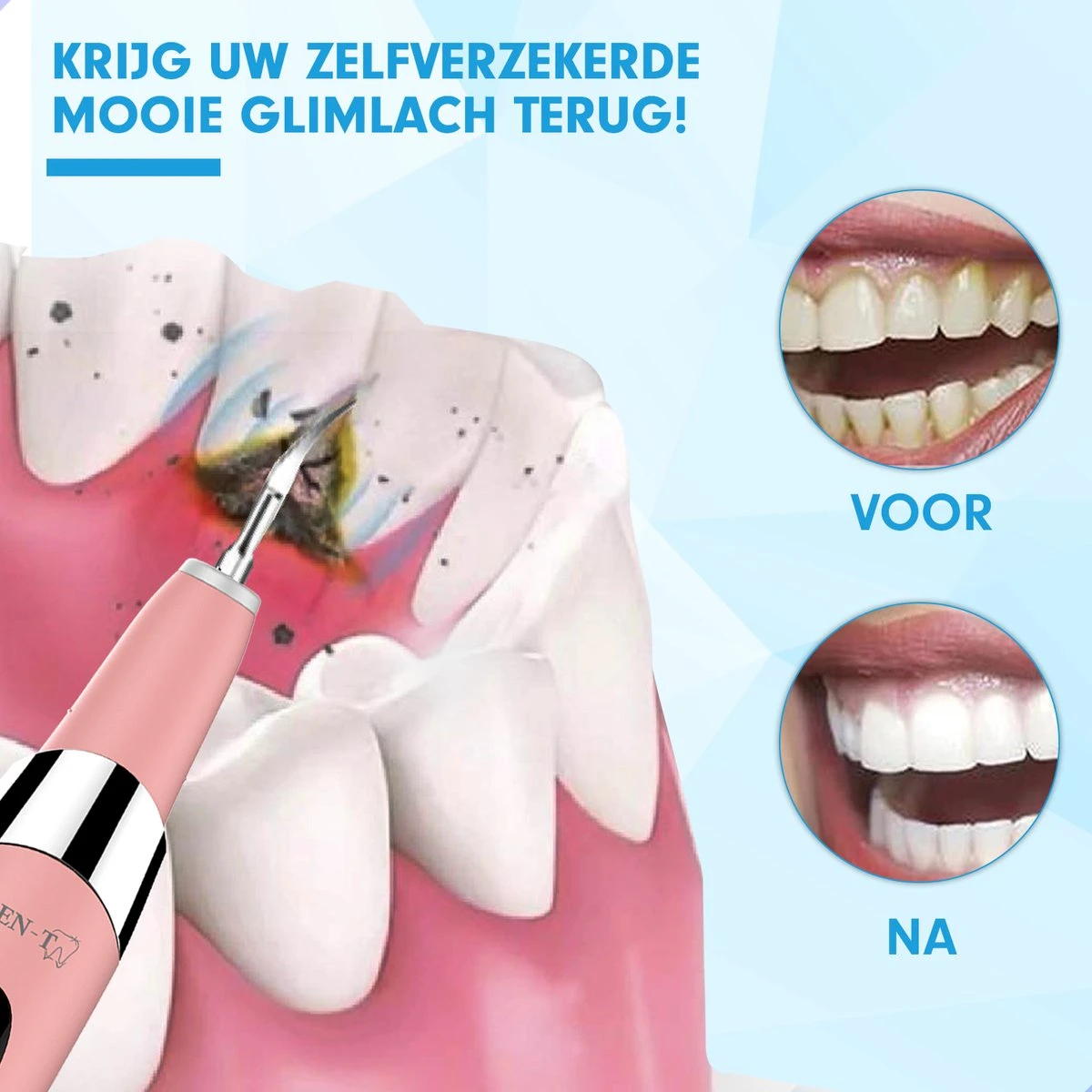 DEN-T® PRO U500 - Elektrische Sonische Tandsteen Verwijderaar - Roze 8 DEN-T® PRO U500 - Elektrische Sonische Tandsteen Verwijderaar - Roze - Afbeelding 8