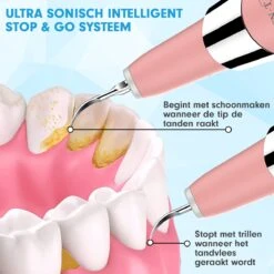 DEN-T® PRO U500 - Elektrische Sonische Tandsteen Verwijderaar - Roze 20 DEN-T® PRO U500 - Elektrische Sonische Tandsteen Verwijderaar - Roze -Verzorgingsproducten 1200x1200 1230