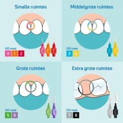 TePe Interdentale Ragers Original Paars ISO Maat 6 – 1,1 Mm (20 Stuks) 6 TePe Interdentale Ragers Original Paars ISO Maat 6 – 1,1 Mm (20 Stuks) -Verzorgingsproducten 1200x1200 1237