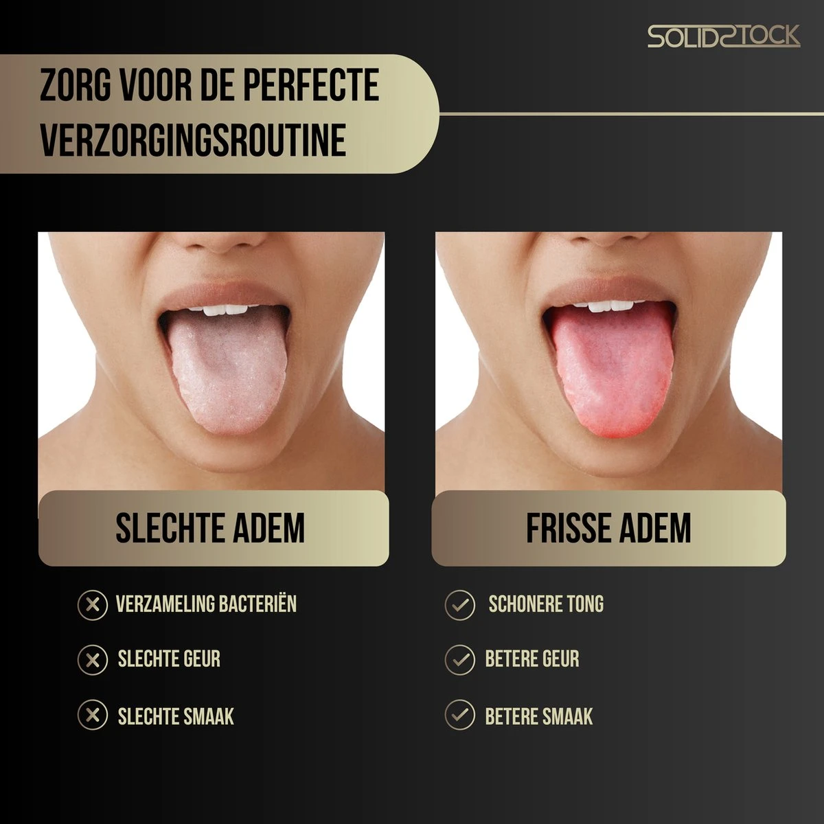 SolidStock Professionele Tongschraper Voor Mondverzorging - 4 Delige Tongreiniger - Ayurveda - RVS 2 SolidStock Professionele Tongschraper Voor Mondverzorging - 4 Delige Tongreiniger - Ayurveda - RVS - Afbeelding 2