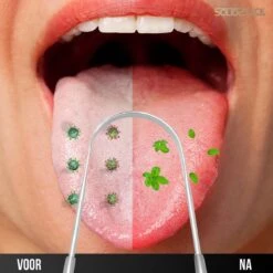 SolidStock Professionele Tongschraper Voor Mondverzorging - 4 Delige Tongreiniger - Ayurveda - RVS 12 SolidStock Professionele Tongschraper Voor Mondverzorging - 4 Delige Tongreiniger - Ayurveda - RVS -Verzorgingsproducten 1200x1200 1270