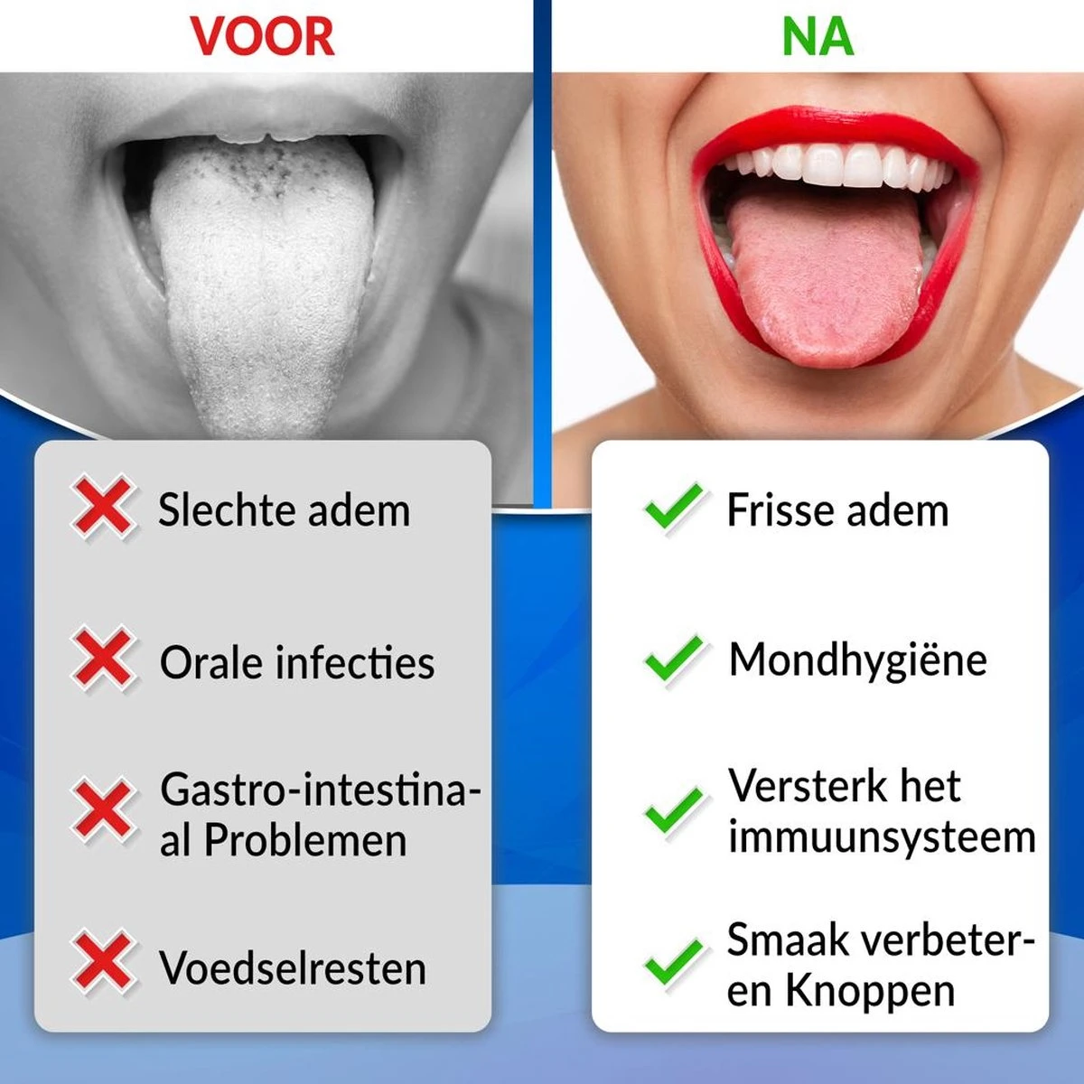 RVS Tongschraper Set - 4 Stuks - Mondverzorging - Tongreiniger, Tongborstel & Tong Schraper 4 RVS Tongschraper Set - 4 Stuks - Mondverzorging - Tongreiniger, Tongborstel & Tong Schraper - Afbeelding 4