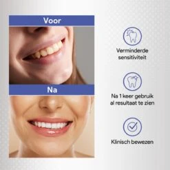 Merkloos Tanden Bleken Met 14 Sets Whitening Strips - Tandenbleekset Met Bamboe Tandenborstel - Tanden Bleekstrips 7 Merkloos Tanden Bleken Met 14 Sets Whitening Strips - Tandenbleekset Met Bamboe Tandenborstel - Tanden Bleekstrips -Verzorgingsproducten 1200x1200 1309