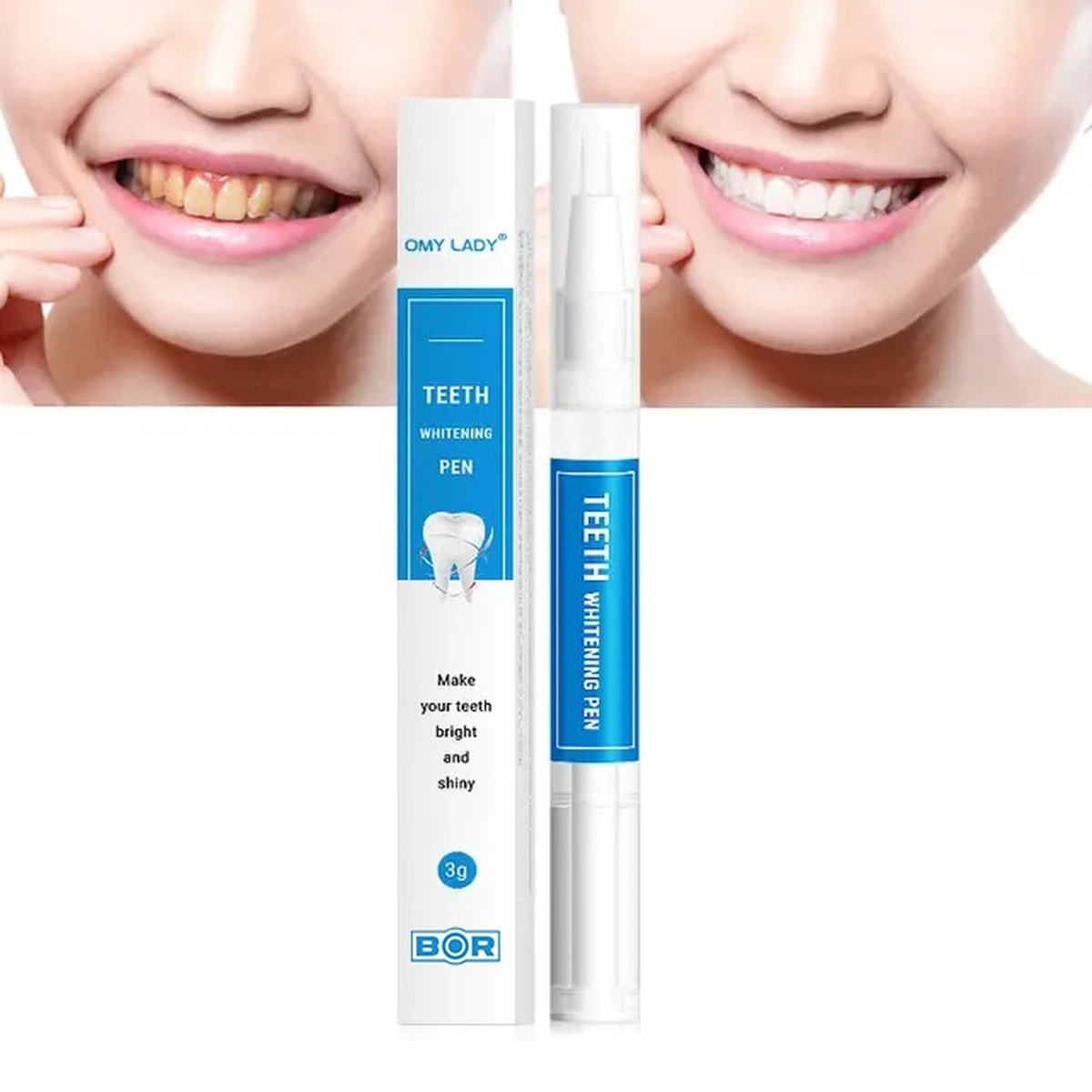 BOR Tanden Bleekpen - Tanden Bleken - Tandenbleekset - Whitening Pen - Tandenblekers - Wittere Tanden - Teeth Whitening Pen - Tanden Bleker 7 BOR Tanden Bleekpen - Tanden Bleken - Tandenbleekset - Whitening Pen - Tandenblekers - Wittere Tanden - Teeth Whitening Pen - Tanden Bleker - Afbeelding 7
