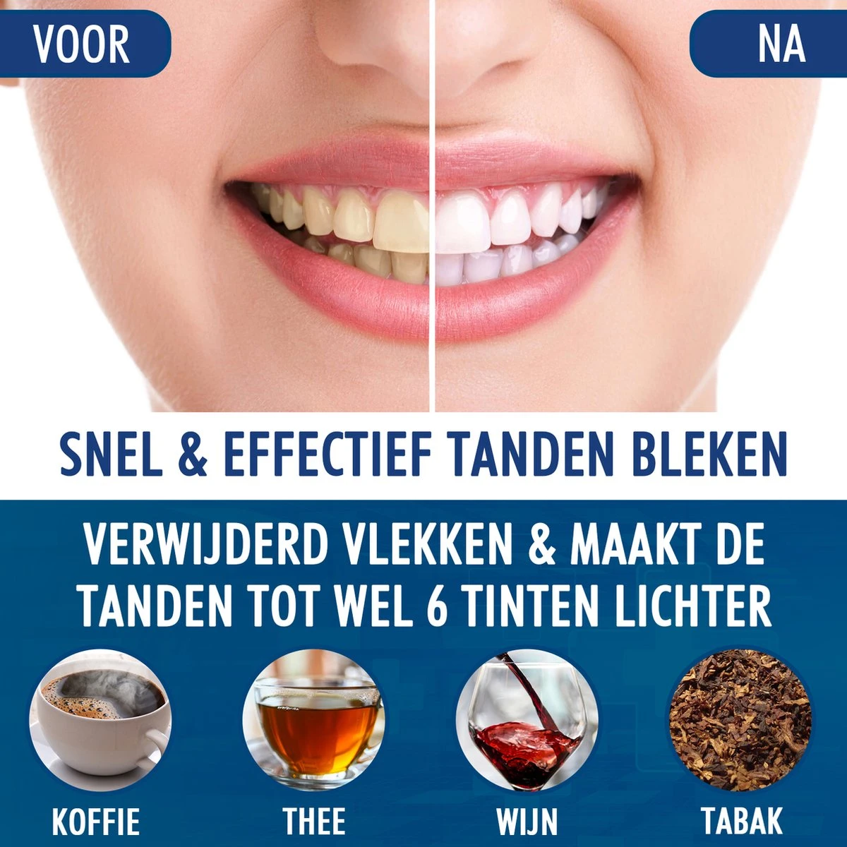 Southland Tandenbleekset - Tandenblekers - Whitening Strips - Teeth Whitening - Tanden Bleken 2 Southland Tandenbleekset - Tandenblekers - Whitening Strips - Teeth Whitening - Tanden Bleken - Afbeelding 2