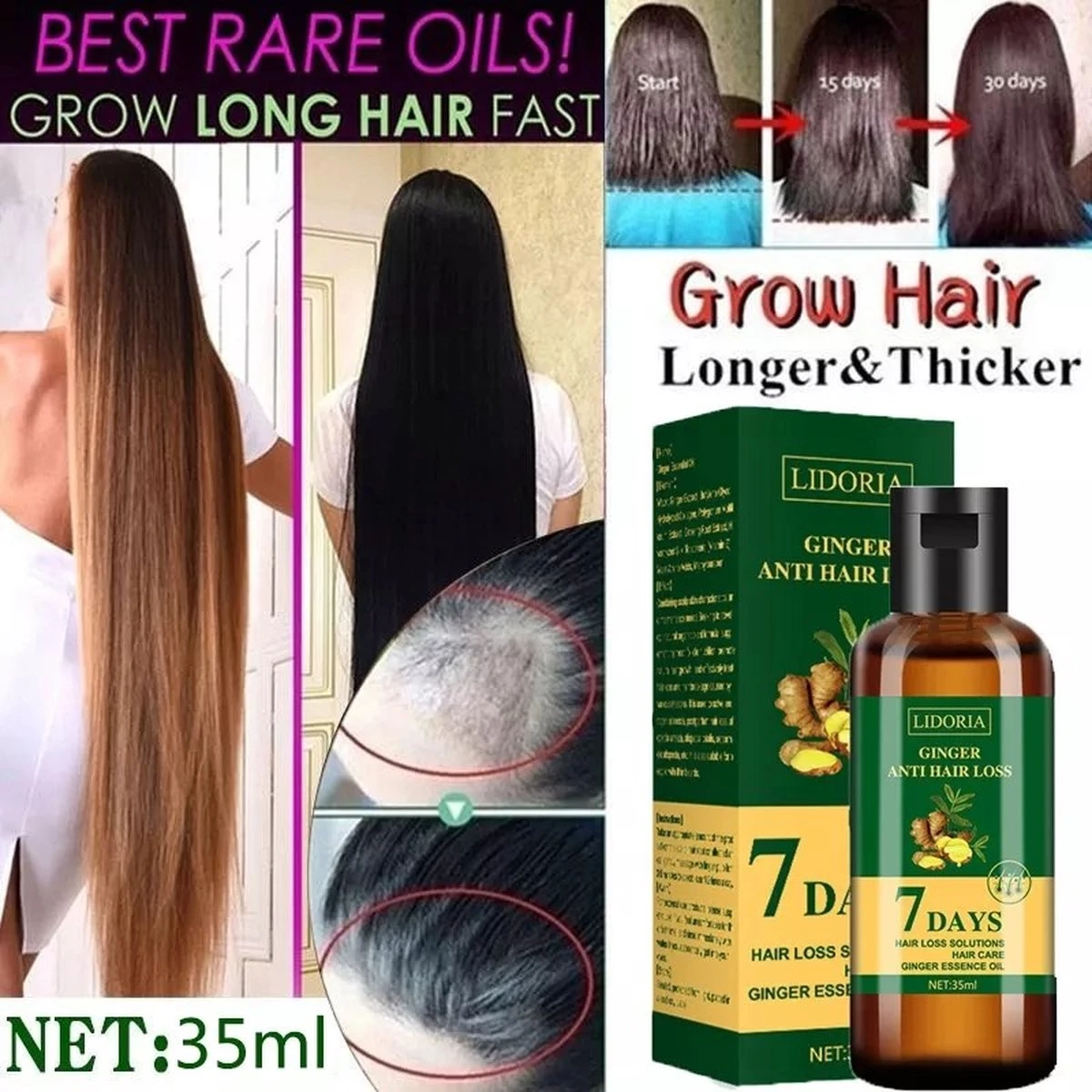 Hair Growth - Essential Oil - Natural - Anti Hair Loss - Fast Grow - Treatment - Men - Woman - Cadeau - 3 Hair Growth - Essential Oil - Natural - Anti Hair Loss - Fast Grow - Treatment - Men - Woman - Cadeau - - Afbeelding 3