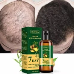 Hair Growth - Essential Oil - Natural - Anti Hair Loss - Fast Grow - Treatment - Men - Woman - Cadeau - 9 Hair Growth - Essential Oil - Natural - Anti Hair Loss - Fast Grow - Treatment - Men - Woman - Cadeau - -Verzorgingsproducten 1200x1200 1674