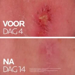 La Roche-Posay Cicaplast Balsem B5+ - 40ml - Voor Gevoelige Huid - Helpt De Huid Herstellen 19 La Roche-Posay Cicaplast Balsem B5+ - 40ml - Voor Gevoelige Huid - Helpt De Huid Herstellen -Verzorgingsproducten 1200x1200 172