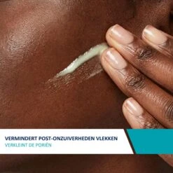 CeraVe Resurfacing Retinol Serum - 30ml - Voor Onzuivere Huid Met Neiging Tot Acne 15 CeraVe Resurfacing Retinol Serum - 30ml - Voor Onzuivere Huid Met Neiging Tot Acne -Verzorgingsproducten 1200x1200 178