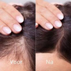 Gember Haargroei Serum - Superdeal - 1 + 1 GRATIS - Gember Haar Spray Voor Haargoei - Vollere Bos Haren - Anti Kaalheid - Haar Wordt Dikker - Ginger Hairspray - Ga Dunner Wordend Haar Tegen - Betere Baardgroei -Verzorgingsproducten 1200x1200 1805