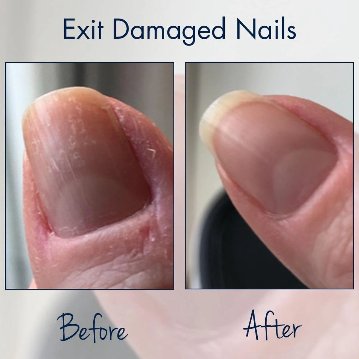 Herome Exit Damaged Nails Nagelolie – Amandelolie Met Vitamines En Mineralen Verbetert En Herstelt De Nagels - 7 Ml. 2 Herome Exit Damaged Nails Nagelolie – Amandelolie Met Vitamines En Mineralen Verbetert En Herstelt De Nagels - 7 Ml. - Afbeelding 2