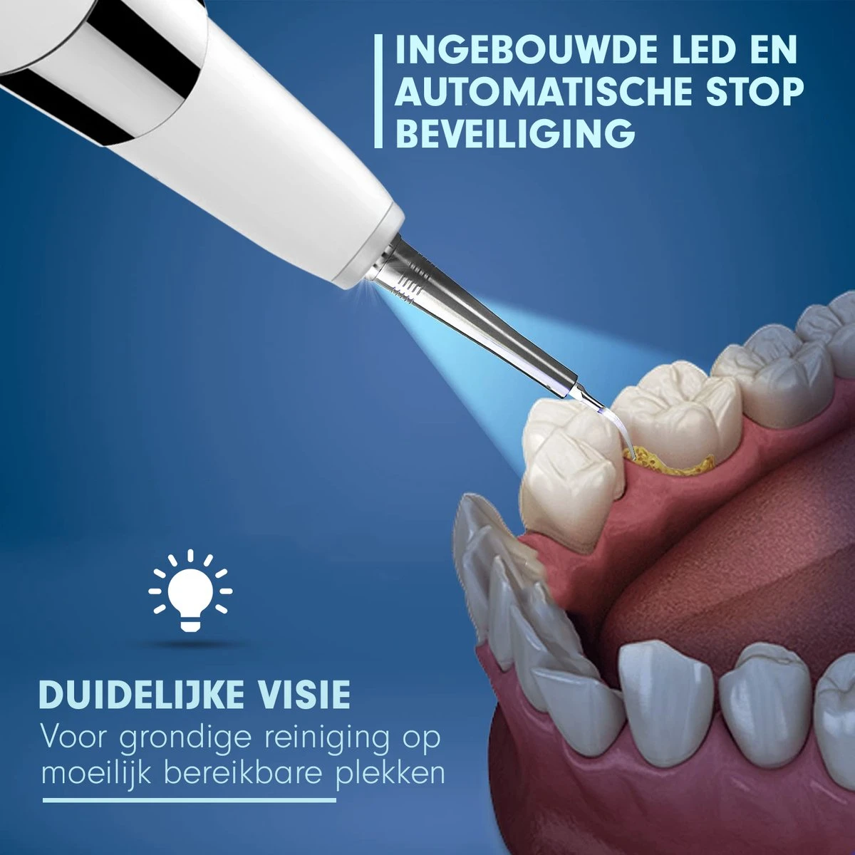 DEN-T® PRO U500 - Elektrische Sonische Tandsteen Verwijderaar - Wit 3 DEN-T® PRO U500 - Elektrische Sonische Tandsteen Verwijderaar - Wit - Afbeelding 3