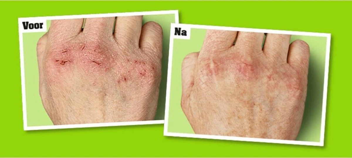 O'Keeffe's - Working Hands Creme - 96 Gram 9 O'Keeffe's - Working Hands Creme - 96 Gram - Afbeelding 9