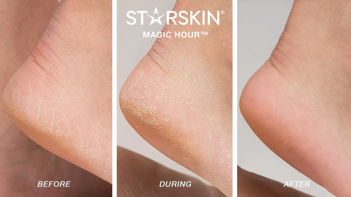 STARSKIN Exfoliating Magic Hour Eeltsokken Voet Masker - Eelt Verwijderaar - Baby Foot Peel Mask 3 STARSKIN Exfoliating Magic Hour Eeltsokken Voet Masker - Eelt Verwijderaar - Baby Foot Peel Mask - Afbeelding 3